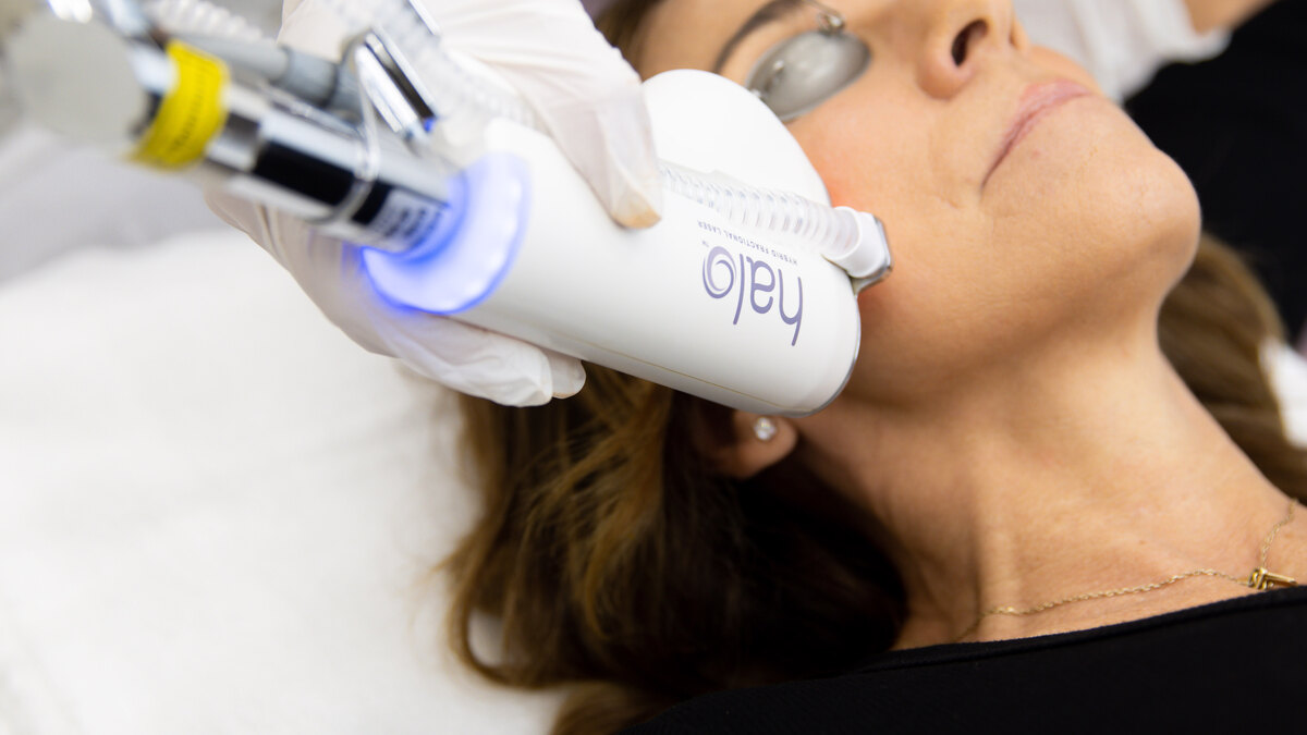 HALO laser treatment at West Coast Plastic Surgery