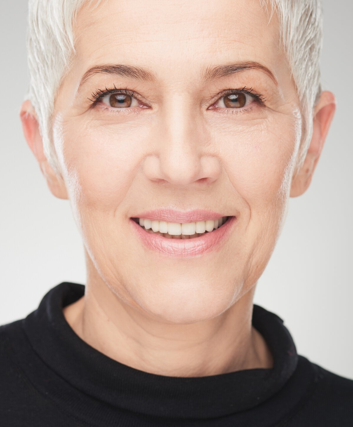 sarasota brow lift model smiling